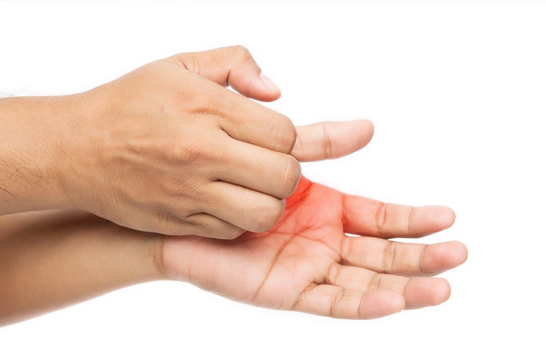 Démangeaisons avec des champignons et son traitement avec de la crème démyxil