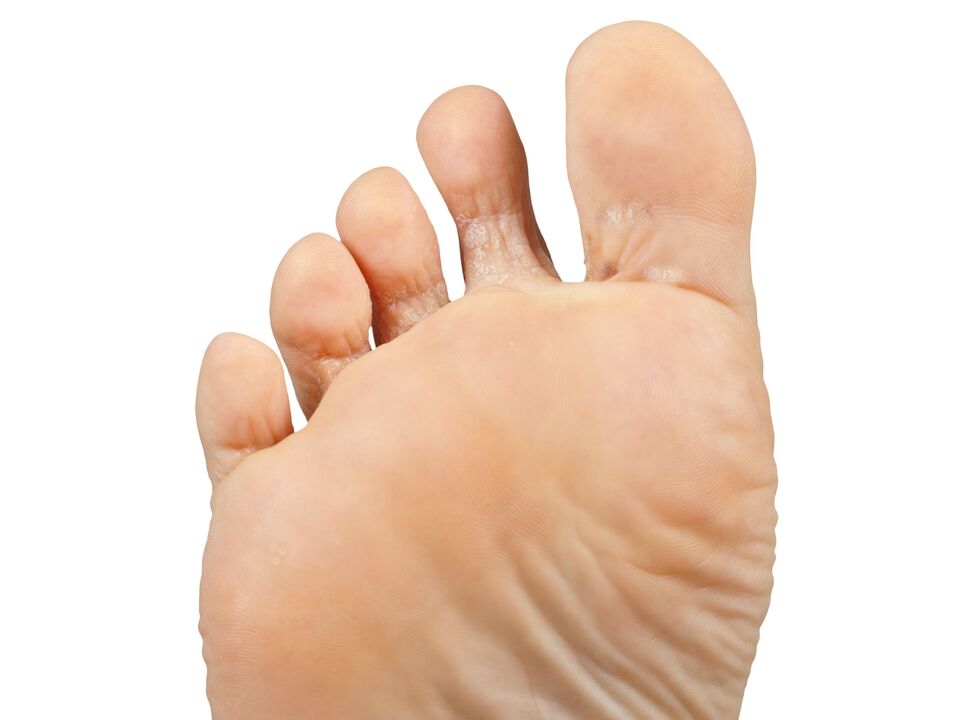 Fumer-and-pair andhectic-cream Demyxil